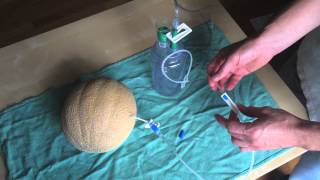 Paracentesis using Turkel Safety Fluid Drainage System [upl. by Kcirrem]