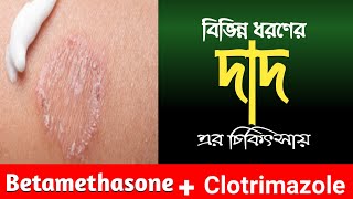 Betamethasone amp Clotrimazole Cream bangla  দাউদের সবচেয়ে ভালো ঔষধ  দাদ চুলকানি দূর করার উপায় [upl. by Dania]