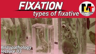 Fixation ।। part01 FIXATION IN HISTOPATHOLOGY ।। Types Of Fixation [upl. by Roseanna]