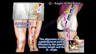 PatelloFemoral Rehabilitation  Runners Knee Exercises  Runners Knee Treatment [upl. by Asusej]