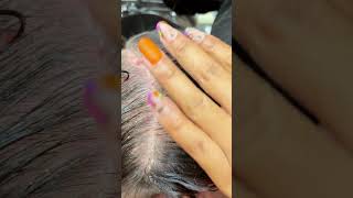 Scalp Treatment and Combing for Dry Scalp scalptreatment [upl. by Asilrahc]