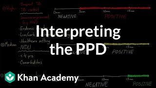 Interpreting the PPD  Infectious diseases  NCLEXRN  Khan Academy [upl. by Lyndon334]