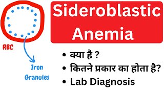 Sideroblastic anemia  Types of sideroblastic anemia  Lab Diagnosis  Pathology [upl. by Lalad779]