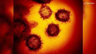 Top 10 Coronavirus Pictures of the Day [upl. by Notwen]