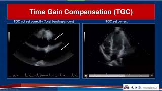 ASE Guidelines for Performing a Comprehensive Echo in Adults Part 1 [upl. by Nadnarb33]