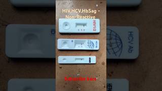 HIV HCV HbSag test  HIVHbSagHCV test kaise kare  pathology medical shorts [upl. by Ahcire]