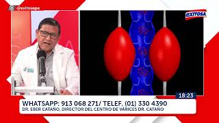 ¿TENER VÁRICES ES PELIGROSO PARA LA SALUD  Dr Eber Cataño en Exitosa [upl. by Ynneb]