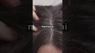 Onion oil for hair growth Less hair fall more shine OnionOil [upl. by Llehctim]