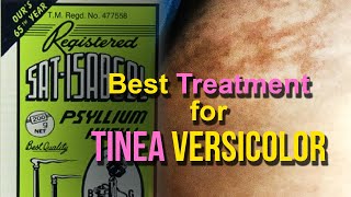 Effective Treatment for Tinea  Pityriasis Versicolor Skin Fungus  Psyllium Husk  Natural Remedy [upl. by Oilisab]