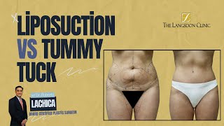 The Surprising TRUTH About Liposuction vs Tummy Tuck [upl. by Alvarez]