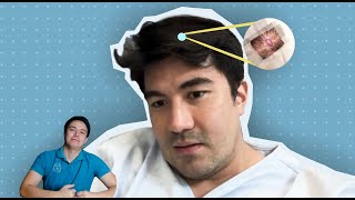 CANCEROUS BA ANG NUNAL NI LUIS MANZANO [upl. by Onitsoga277]