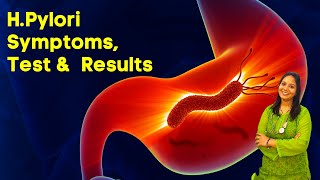 HPylori Test in Hindi  Symptoms Test and Results in Hindi [upl. by Lona]