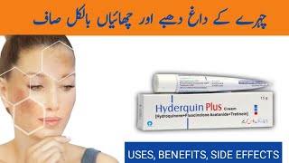 How To Treat Pigmentation  Chehre ki Chaiyon ka Ilaaj [upl. by Oiludbo]