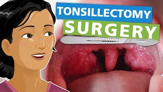 Tonsillectomy Surgery [upl. by Fiel]