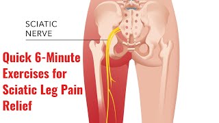 The Best Exercises for Sciatic Leg Pain Relief [upl. by Eiknarf278]