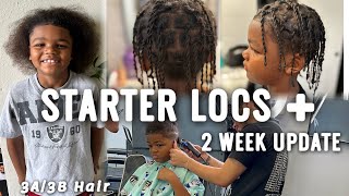 3A3B Starter Locs  2 week update [upl. by Musa198]