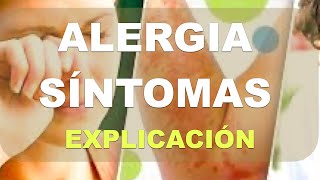 ¿Por qué la alergia produce PICOR o SECRECIÓN Rinitis alérgica [upl. by Hallee115]