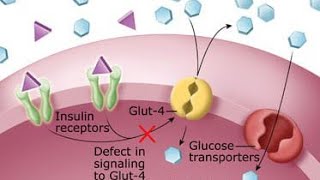 DIABETES MELLITUS  Endocrine System  PATHOLOGY [upl. by Rorke]