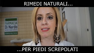 Talloni screpolati Rimedi pratici [upl. by Skye194]