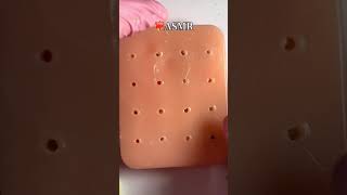 ASMR ear cleaning asmrsounds asmr blackdots asmrcosmetologist viral skincare acnetreatment [upl. by Ailerua]