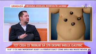 Tot ce trebuie să știi despre balonul și inelul gastric Beneficiile și riscurile intervenției [upl. by Halden]