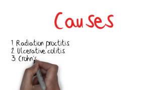 What Is Proctitis And Radiation Proctitis [upl. by Essilrahc]