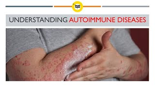 Understanding Autoimmune Diseases Causes and Symptoms [upl. by Orms]