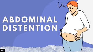 Abdominal Distention Everything You Need To Know [upl. by Ainek]