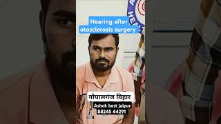 Hearing after otosclerosis surgery ashokbest jaipur 88245 44291 👂 [upl. by Eedahs]