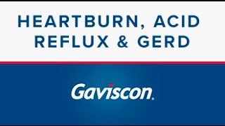 Heartburn Acid Reflux and GERD  Gaviscon® [upl. by Blainey]