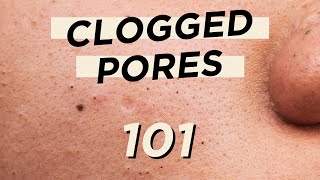 🤭Everything you need to know about CLOGGED PORES • Skincare amp makeup products are not the culprit [upl. by Alyek]