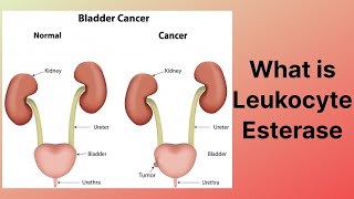 What is Leukocyte Esterase [upl. by Labaw]