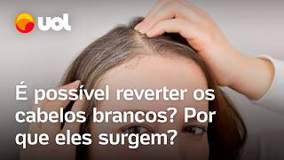 Cabelo branco é possível reverter Estresse sono irregular e má alimentação influenciam confira [upl. by Zephaniah]