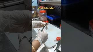 Gall bladder cutting video  histopathology gallstonelasersurgery meat histology ovariancyst [upl. by Eldwon]