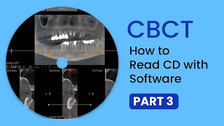 CBCT Part 3 How to read cbct on Dental Software for implant planning and diagnosis making [upl. by Batory138]