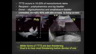 UCSF Radiology Problems with Twins [upl. by Oicnevuj]