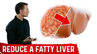 The Best Fatty Liver Exercise – Treatment of Fatty Liver – DrBerg [upl. by Riabuz]