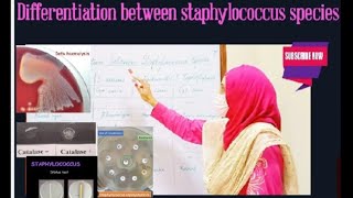 Differences between staphylococcus species [upl. by Annoynek316]