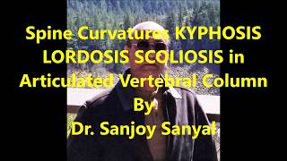 Spine Curvatures KYPHOSIS LORDOSIS SCOLIOSIS in Articulated Vertebral Column – Sanjoy Sanyal [upl. by Erna404]