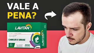 Lavitan Hair Tratamento Contra Queda de cabelo e Calvície Masculina Lavitan Hair  Aula 14 [upl. by Eymaj398]