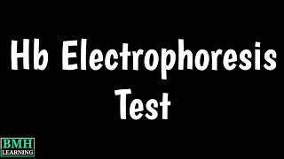 Hb Electrophoresis Test  Hb HPLC Test  Hb Electrophoresis By HPLC [upl. by Cissej]