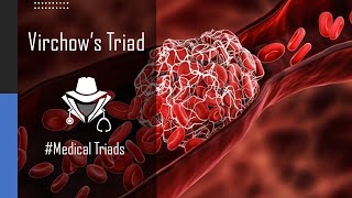 Virchows Triad of Thrombosis  Shorts MedicalTriads [upl. by Rosana]