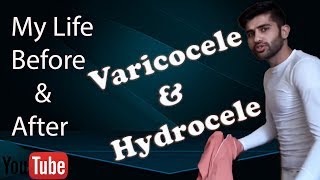 Varicocele treatment  My Story about Varicocele amp Hydrocele after amp before  without surgery amp med [upl. by Annaik]