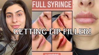 I GOT LIP FILLER Before After and Healing Process Restylane Kysse Lip Filler [upl. by Holladay861]