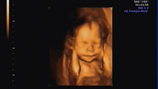 Video Ecografia 4D 6 meses y 1 semana ultrasound [upl. by Roselba]