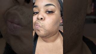 41924 face wax w tresswellness 🩷 pcos hirsutism facewax hardwax daquanawhite [upl. by Anifur773]