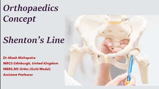 What is Shentons Line  neetpg inicet orthopaedics concept mrcs plab1 usmle onlinelearning [upl. by Lichtenfeld685]