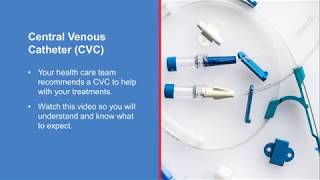 Central venous catheter procedure [upl. by Vahe]