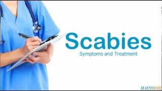 Scabies ¦ Treatment and Symptoms [upl. by Yelra]