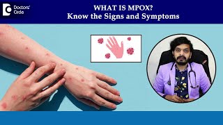 Monkeypox rash on skin  MPox Symptoms amp Diagnosis Mpox PhasesDrLeela Mohan P V RDoctors Circle [upl. by Gibbeon]